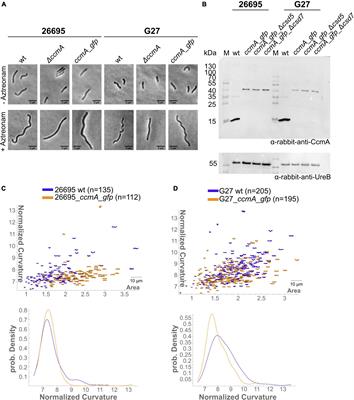 Insights Into the Helical Shape Complex of Helicobacter pylori